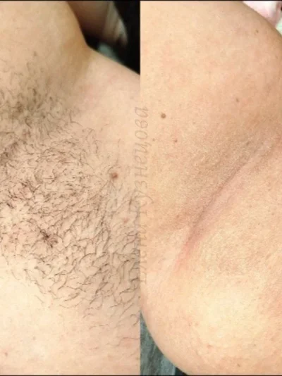 Фото 8
